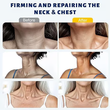5-Roller Neck Firming Cream – Collagen & Hyaluronic Acid for Smoother, Tighter-Looking Neck Skin